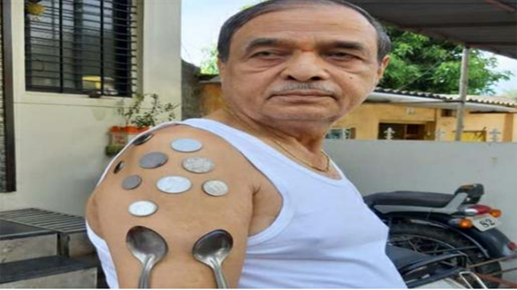 …आणि त्यांच्या शरीराला चिकटले चमचे, नाणी