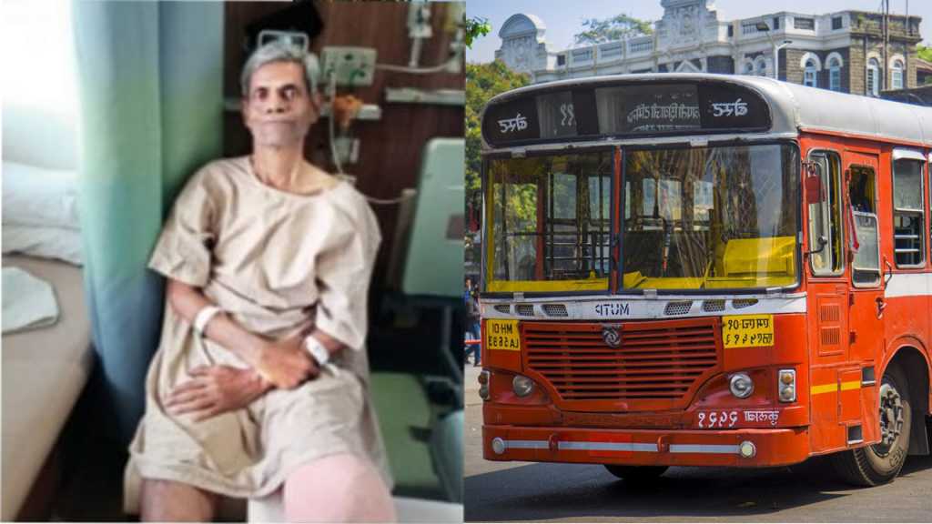 बसमुळे पाय कापलेल्या कर्मचाऱ्याकडे दुर्लक्ष