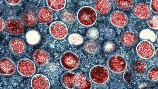 चीनच्या वुहान प्रयोगशाळेत कोविड सारखा बॅट विषाणू