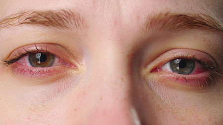 तासभर रील्स पाहिल्यास डोळ्यांवर ताण