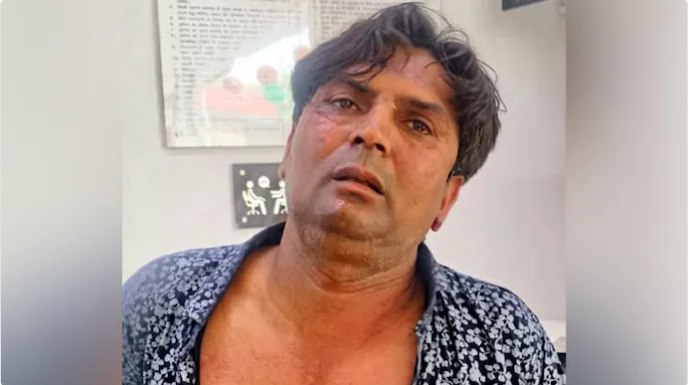 मुख्यमंत्र्यांवरील हल्लेखोर मानसिकदृष्ट्या आजारी, भटक्या कुत्र्यांच्या निर्णयामुळे होता नाराज!