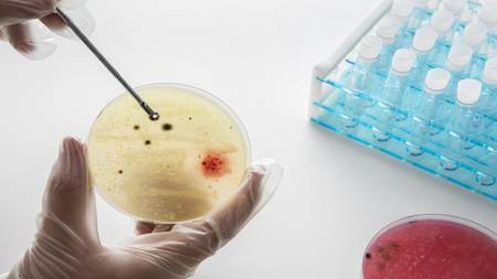 स्टेरॉइड्समुळे टीबी रुग्णांना मिळू शकतो चांगला उपचार