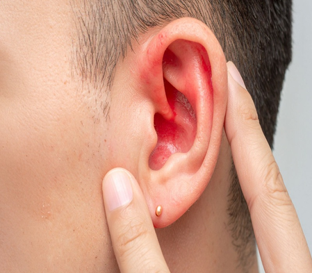 हिवाळ्यात कानांची काळजी घेणे का आवश्यक आहे?